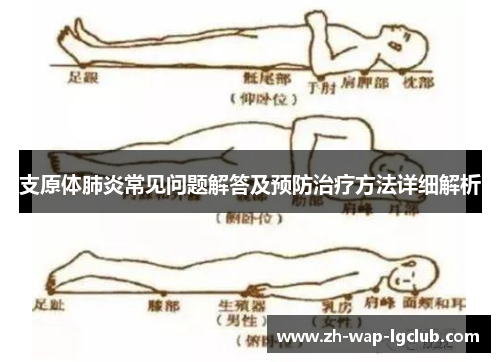 支原体肺炎常见问题解答及预防治疗方法详细解析